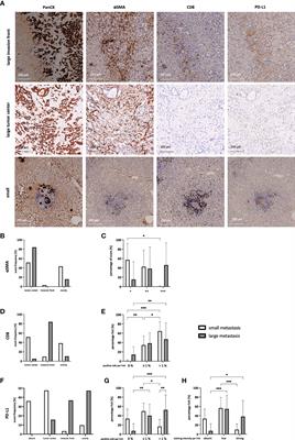Hepatic myofibroblasts exert immunosuppressive effects independent of the immune checkpoint regulator PD-L1 in liver metastasis of pancreatic ductal adenocarcinoma